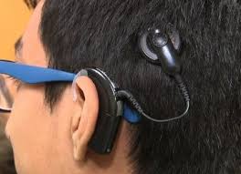 Cochlear Assistive Devices Market