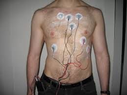 Continuous Cardiac Monitoring Devices