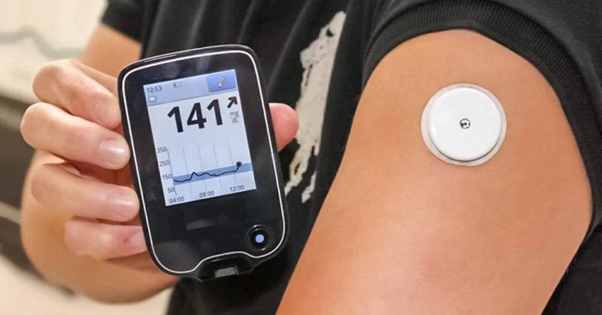 Continuous Glucose Monitoring (CGM) Systems for Diabetics