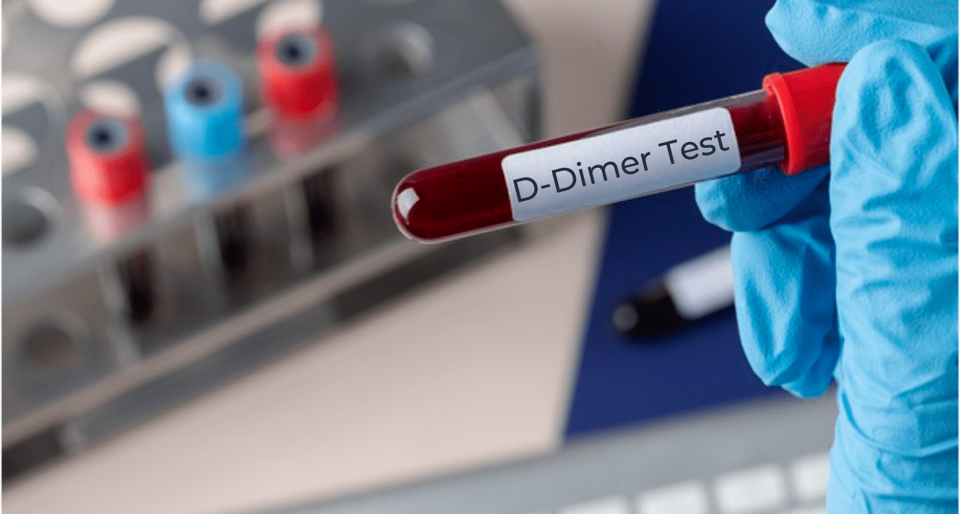 D-dimer Testing market