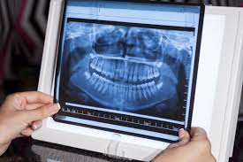 Dental Panoramic Radiography