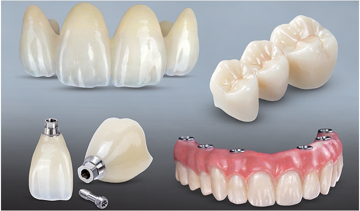 Dental Restorative Supplies