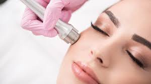 Dermabrasion and Microneedling market