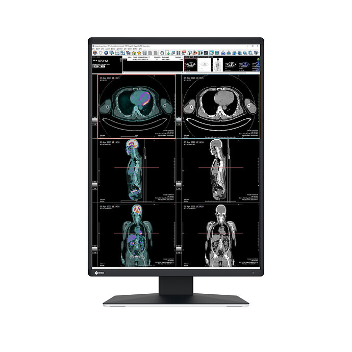 Diagnostic Display Monitors