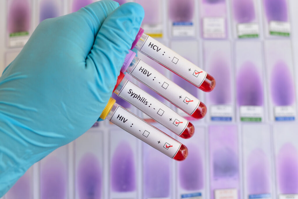 Diagnostic Testing of STDs market