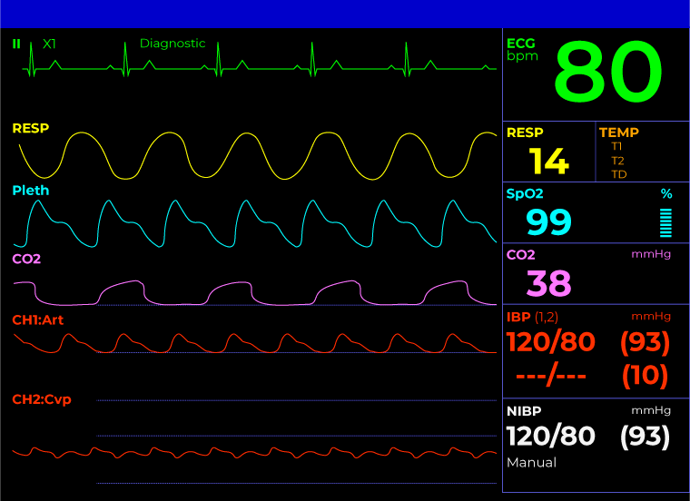 ECG Patient Monitors