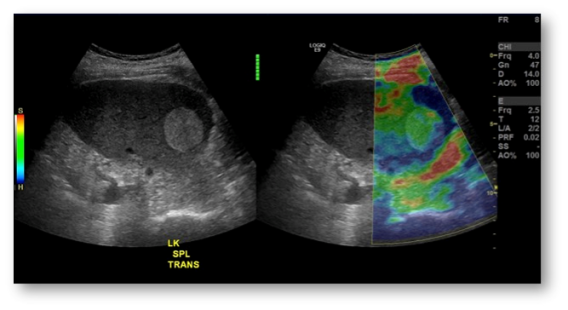 Elastography Imaging Market