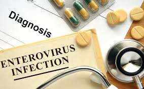 Enterovirus Diagnostic