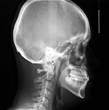 Extraoral X-ray Imaging