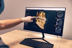 Flat Panel Detector Based X-ray For Cone Beam Computed Tomography