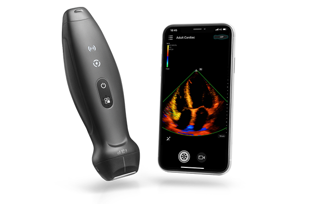 Hand-held Ultrasound System market