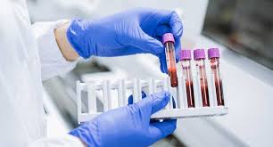 Hematology Diagnostics