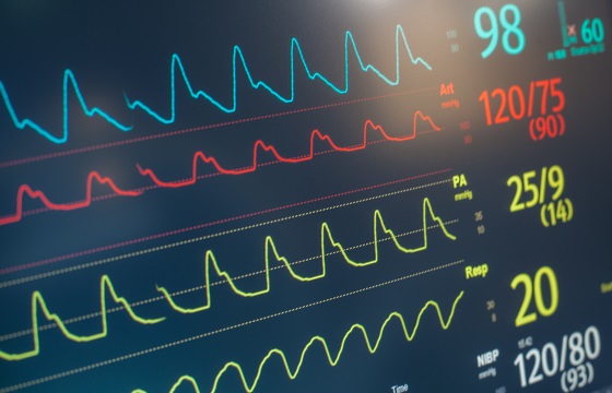 Hemodynamic Monitors