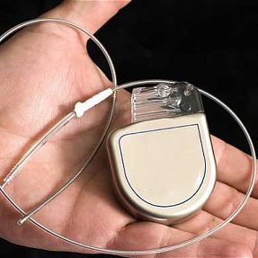 Implantable Cardioverter Defibrillator (ICD) Devices