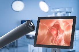 Intestinal Capsule Endoscopy System Market