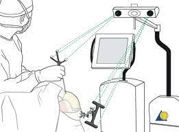 Maxillofacial Surgery Navigation System Market