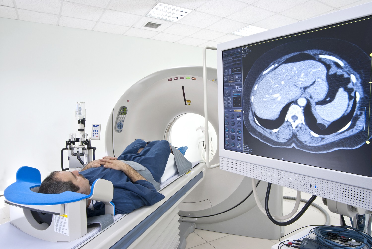 Medical Diagnostic Imaging market