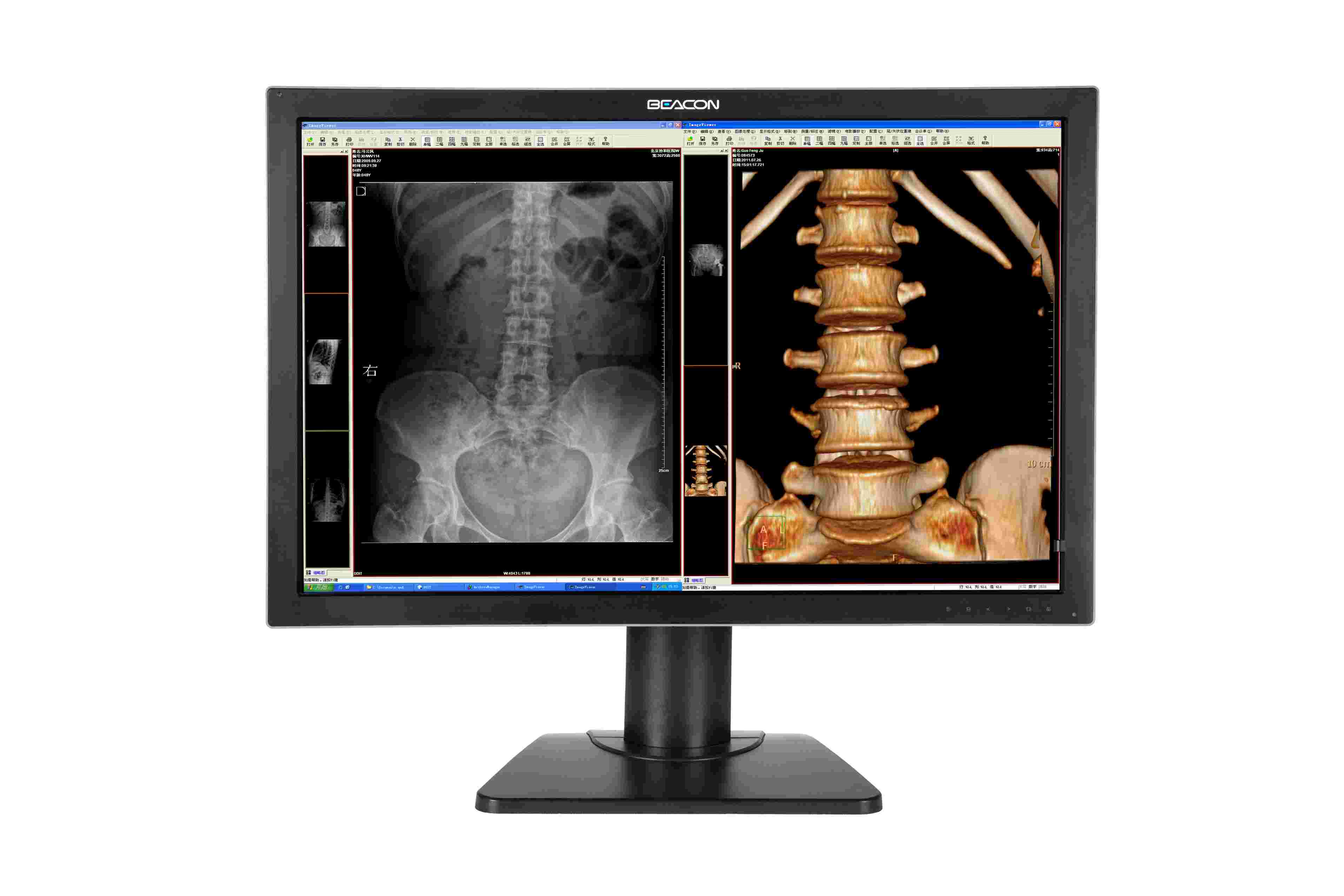 Medical Diagnostic Radiology Display