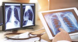 Medical Digital Radiography Detectors Market