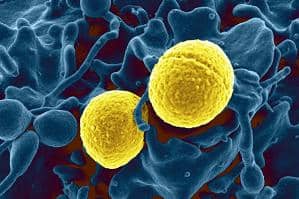 Methicillin-Susceptible Staphylococcus Aureus market