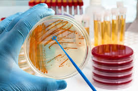 Microbial Testing market