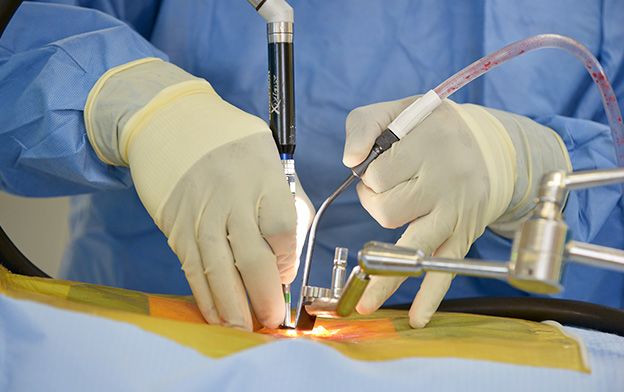 Minimally Invasive Spine Surgery Retractor