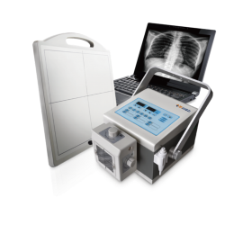 Mobile X-ray Machines