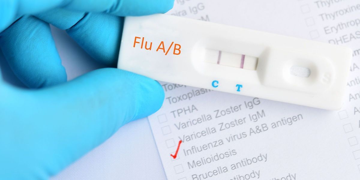 Molecular Influenza Diagnostic