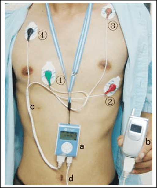 Monitoring Electrodes