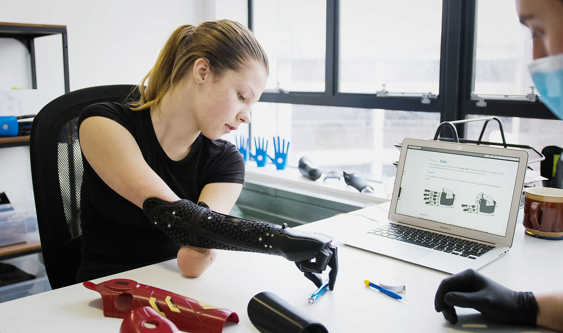 Myo-electric Hand Prosthesis Market