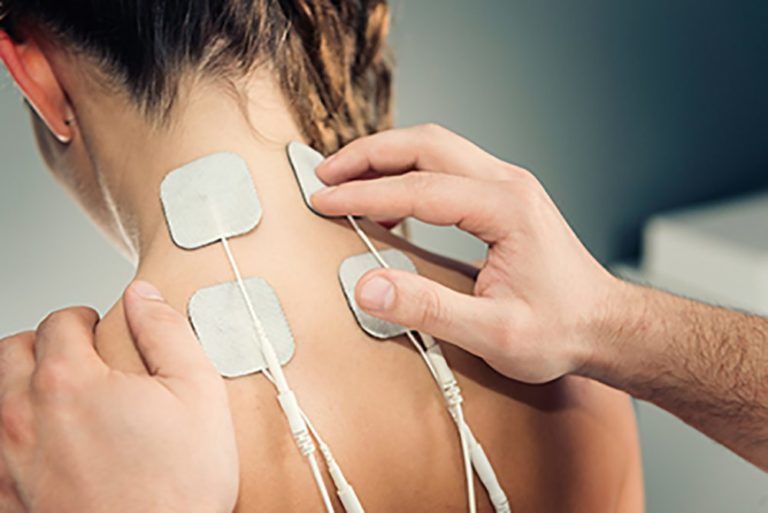 Nerve Stimulators