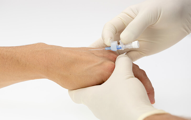 Peripheral IV Cannula