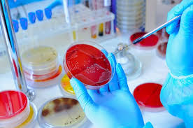 Pharma Microbiology Testing Kits