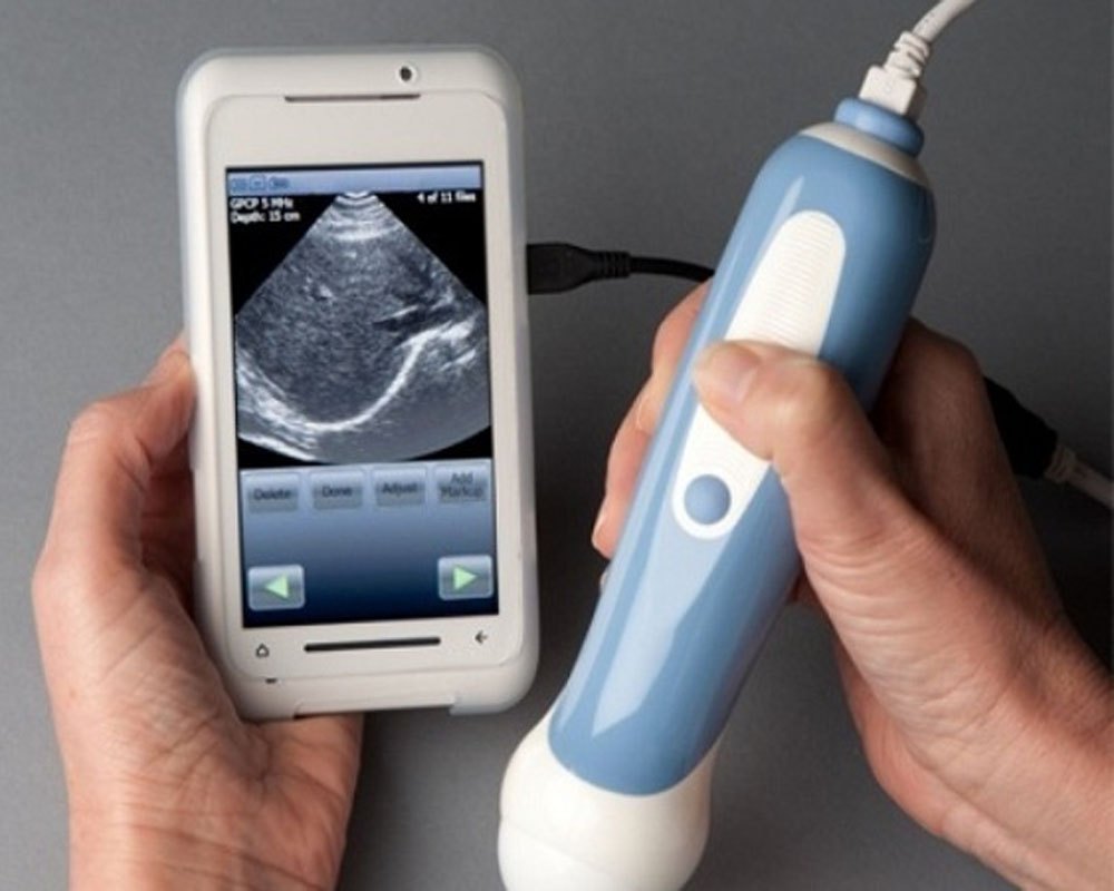 Portable Ultrasound