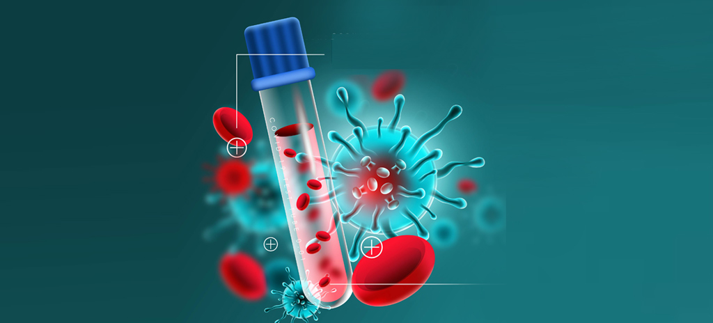 RT-PCR Test Kits market