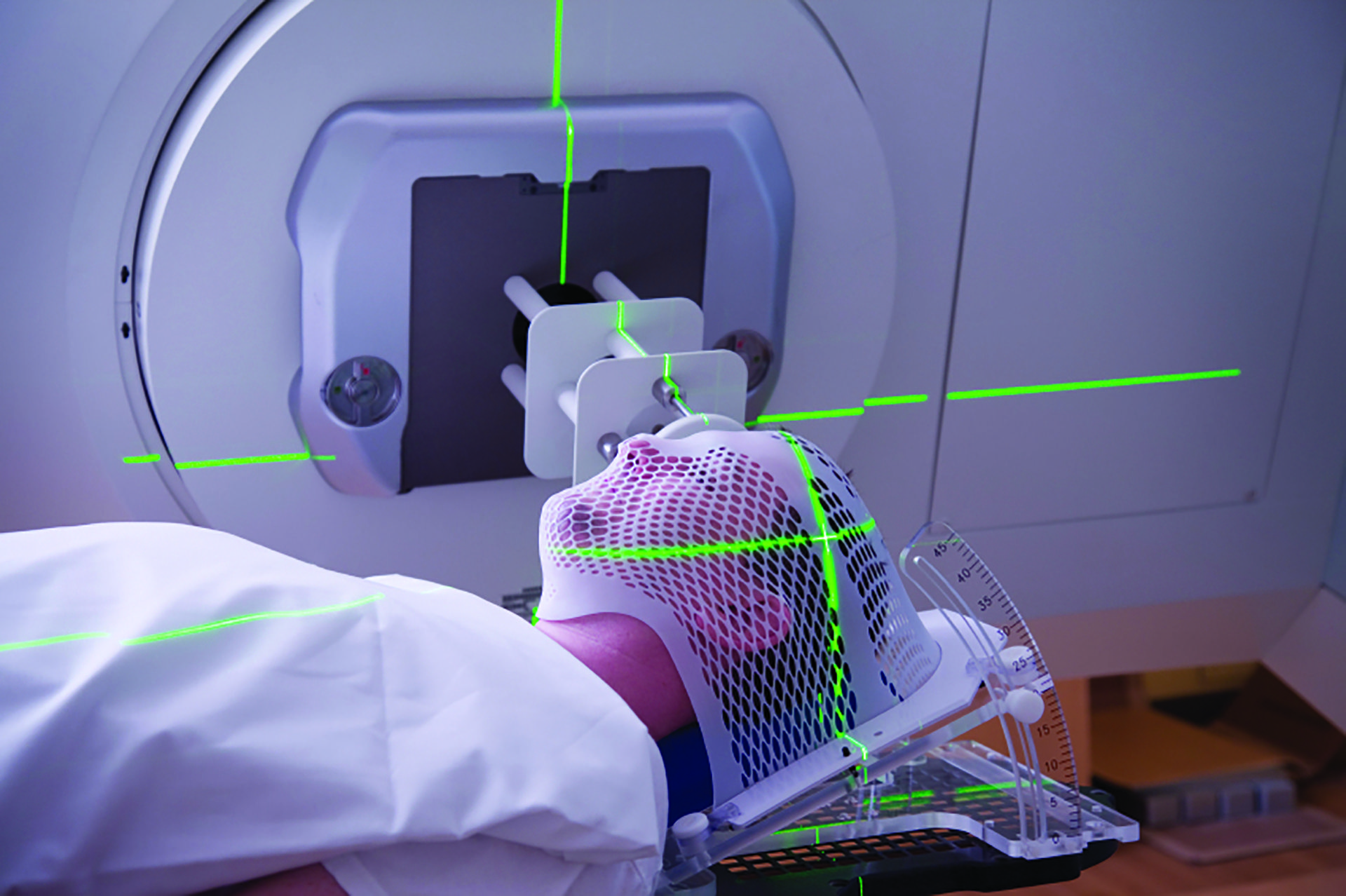 Radiotherapy Patient Positioning Devices