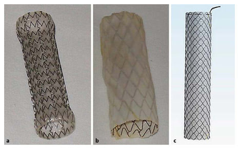 Self-Expanding Metallic Stents