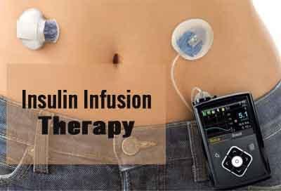 Subcutaneous Insulin Infusion Therapy market