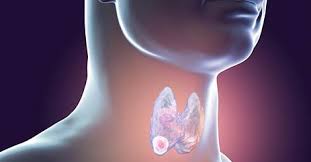 Throat Cancer Treatment market