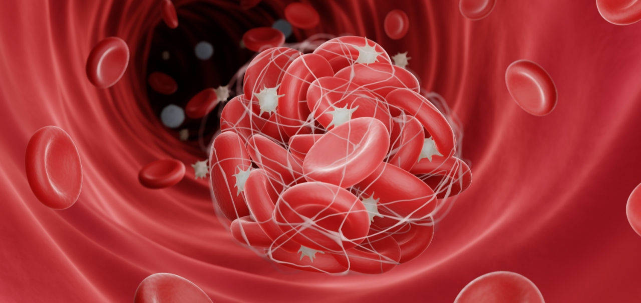 Thrombosis and Hemostasis Biomarkers