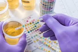 Urine Test Analysis