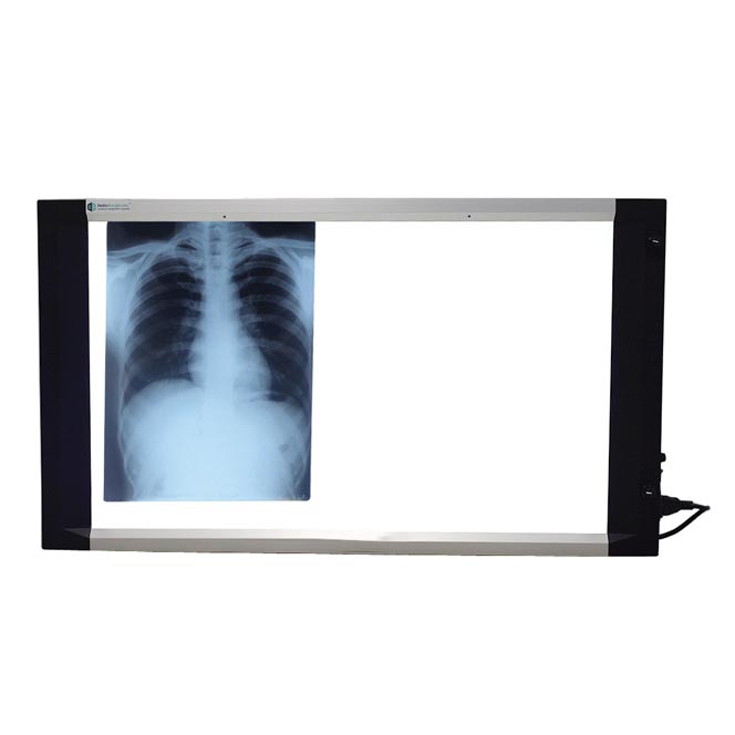 X-Ray Viewing Screens Market